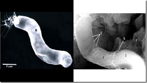 actual bacterium