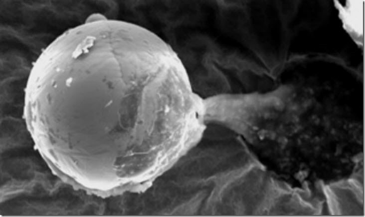 microesfera