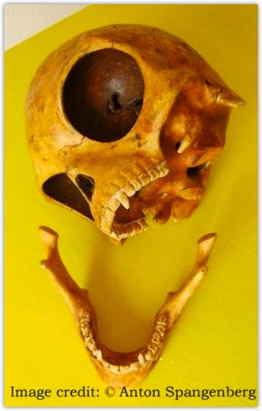 skull2
